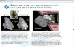 Embedded thumbnail for Микротомография биологических объектов: технология 3D морфологического анализ. Микротомография биологических объектов в медицине.